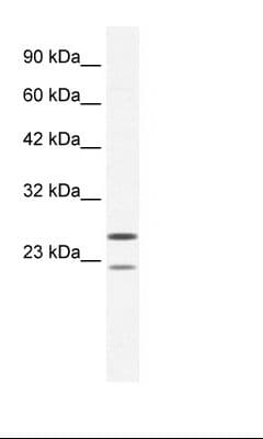 Polyclonal Rabbit anti-Human TRIM14 Antibody (aa116-165, IHC, WB)