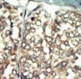 PI4K2B Antibody (aa305-336)