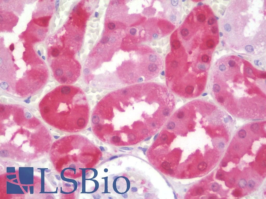 IHC-plus™ NNMT Antibody (clone 3D8)