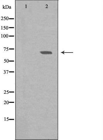 Polyclonal Rabbit anti-Human TESK2 Antibody (WB)