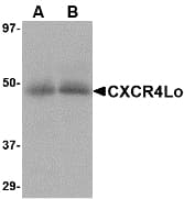 Polyclonal Rabbit anti-Human CXCR4 Antibody (IF, WB)