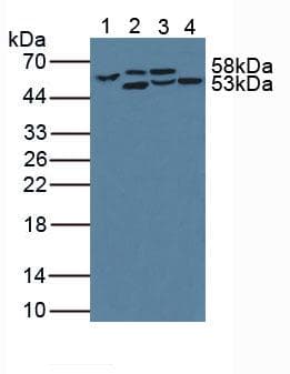PH / PAH Antibody (aa228-452)