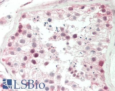 IHC-plus™ Polyclonal Rabbit anti-Human SALL4 Antibody (aa493-526, IHC, WB)