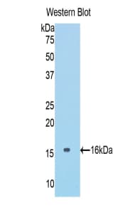COL6A1 / Collagen VI Alpha 1 Antibody (aa82-212, FITC)