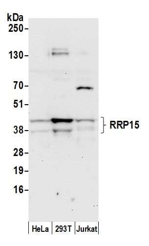 Polyclonal Rabbit anti-Human RRP15 Antibody (aa75-125, WB)