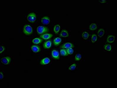 Endogenous Retrovirus HERV-K10 putative protease Antibody