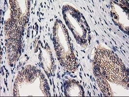 Monoclonal Mouse anti-Human EIF4E2 / IF4e Antibody (clone OTI1F2, IHC, WB)