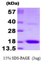 Human PTS Protein (Recombinant His)