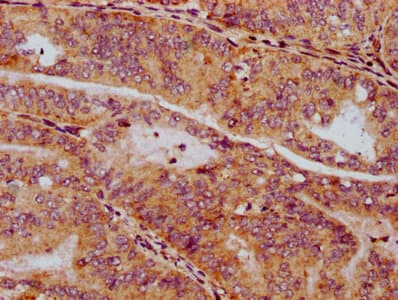 SV2C Antibody