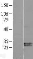 SOD3 Protein (Over-Expression Lysate Myc-DDK (Flag))
