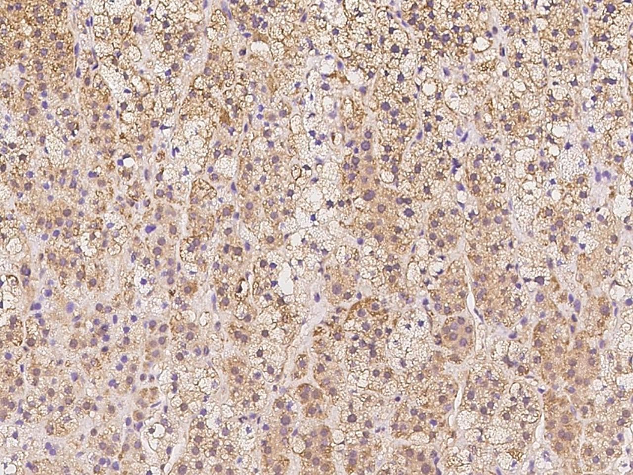 Polyclonal Rabbit anti-Human C12orf57 Antibody (IHC)
