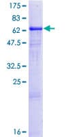 Human CA14 / Carbonic Anhydrase XIV Protein (Recombinant GST)