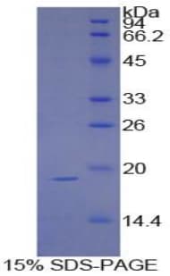 Human SI / Sucrase Isomaltase Protein (Recombinant His-S)