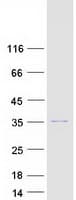 Human TSNAX / TRAX Protein (Recombinant Myc-DDK (Flag))