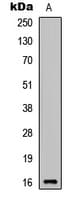 Polyclonal Rabbit anti-Human CYTL1 / C17 Antibody (Internal, WB)