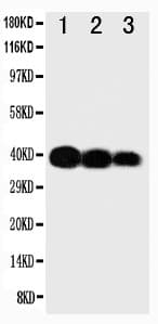 Polyclonal Rabbit anti-Human IL12B / IL12 p40 Antibody (aa23-40, WB)