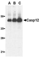PathPlus™ Polyclonal Rabbit anti-Human CASP12 / Caspase 12 Antibody (IHC, IF, WB)