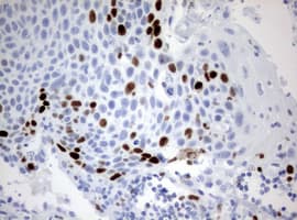 Monoclonal Mouse anti-Human MKI67 / Ki67 Antibody (clone OTI14G1, aa1160-1493, IHC)