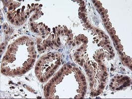 Monoclonal Mouse anti-Human LCMT1 Antibody (clone OTI2C9, IHC, WB)