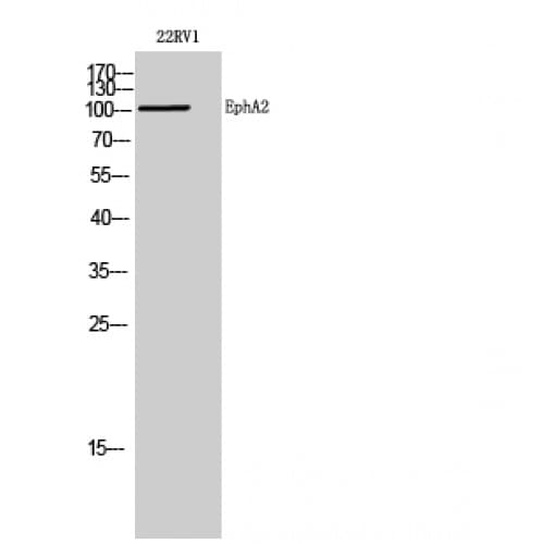EPHA2 / EPH Receptor A2 Antibody (100-180 aa, N-terminal)