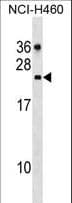 CDC42EP2 Antibody (aa133-160)