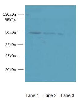 Polyclonal Rabbit anti-Human PA2G4 / EBP1 Antibody (IHC, WB)