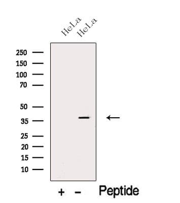 Polyclonal Rabbit anti-Human CAPG Antibody (WB)