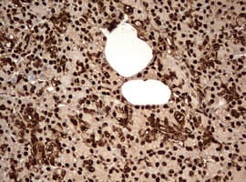 Monoclonal Mouse anti-Human GAPDH Antibody (clone OTI2F9, IHC, WB)