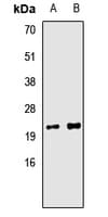 Polyclonal Rabbit anti-Human TIMM10B / FXC1 Antibody (IHC, WB)