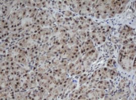 Cullin 4B / CUL4B Antibody (clone OTI1C4)