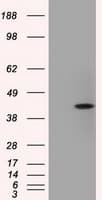 ACAT2 Antibody (clone OTI3A11, Carrier-free)