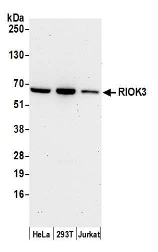 RIOK3 Antibody (aa469-519)