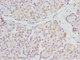 Polyclonal Rabbit anti-Human SFRP-3 / FRZB Antibody (IHC)
