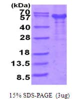 Human IL12RB1 / CD212 Protein (Recombinant His)