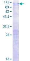 Human ITPKB Protein (Recombinant GST)