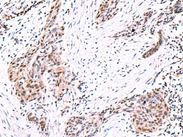 POLD2 Antibody