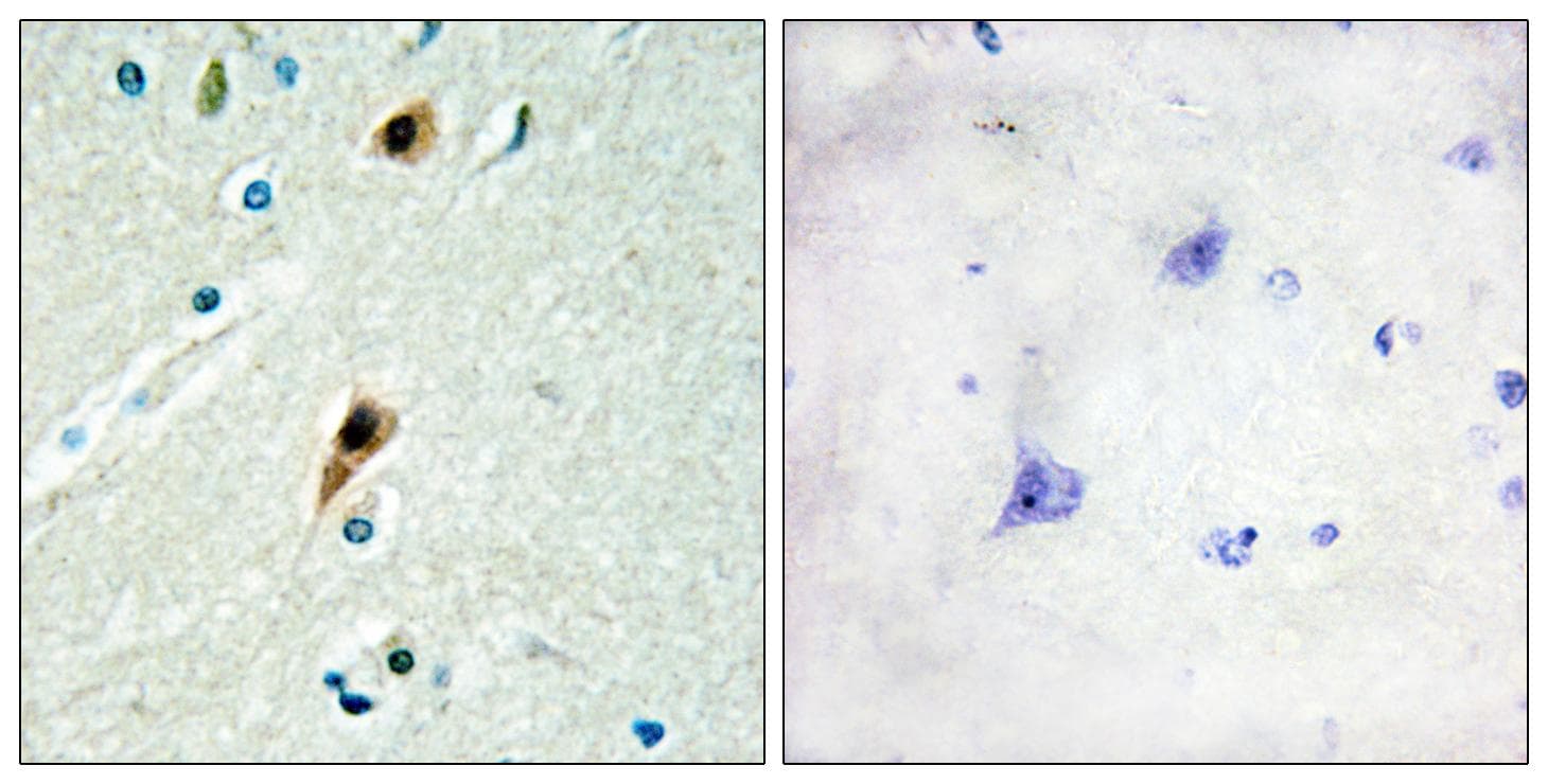 Polyclonal Rabbit anti-Human RBM5 / G15 Antibody (WB)