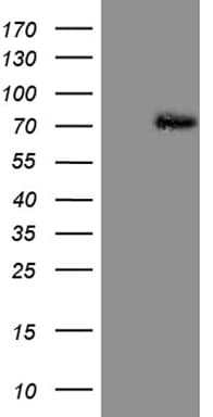 Monoclonal Mouse anti-Human PIAS2 / PIASX Antibody (clone OTI5B4, WB)