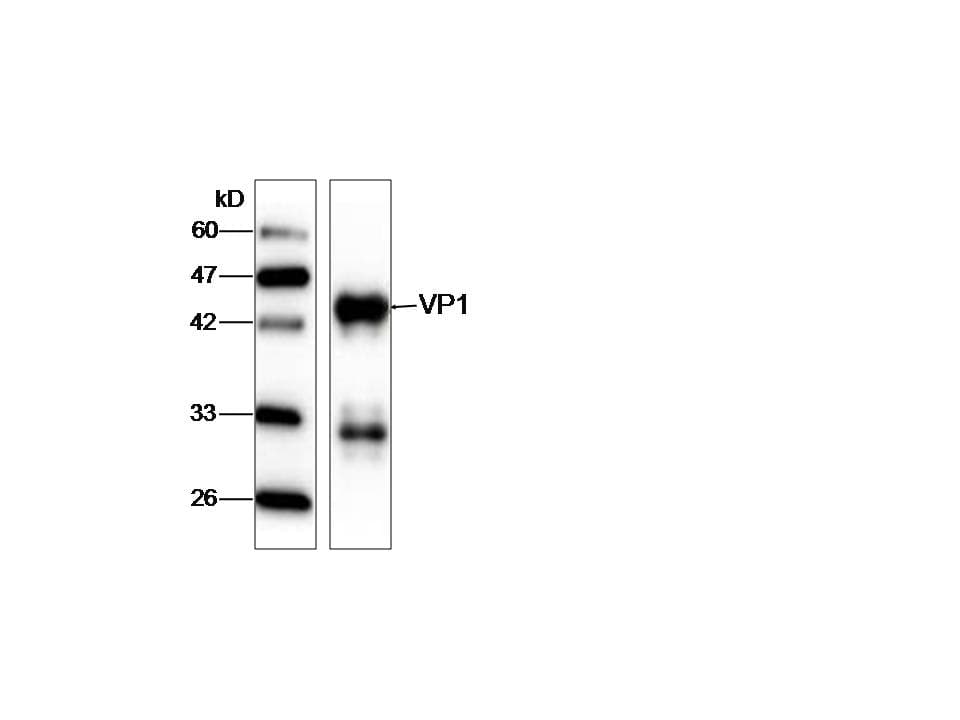Monoclonal Mouse anti-Hepatitis A Virus HAV VP1 Antibody (aa7-143, WB)