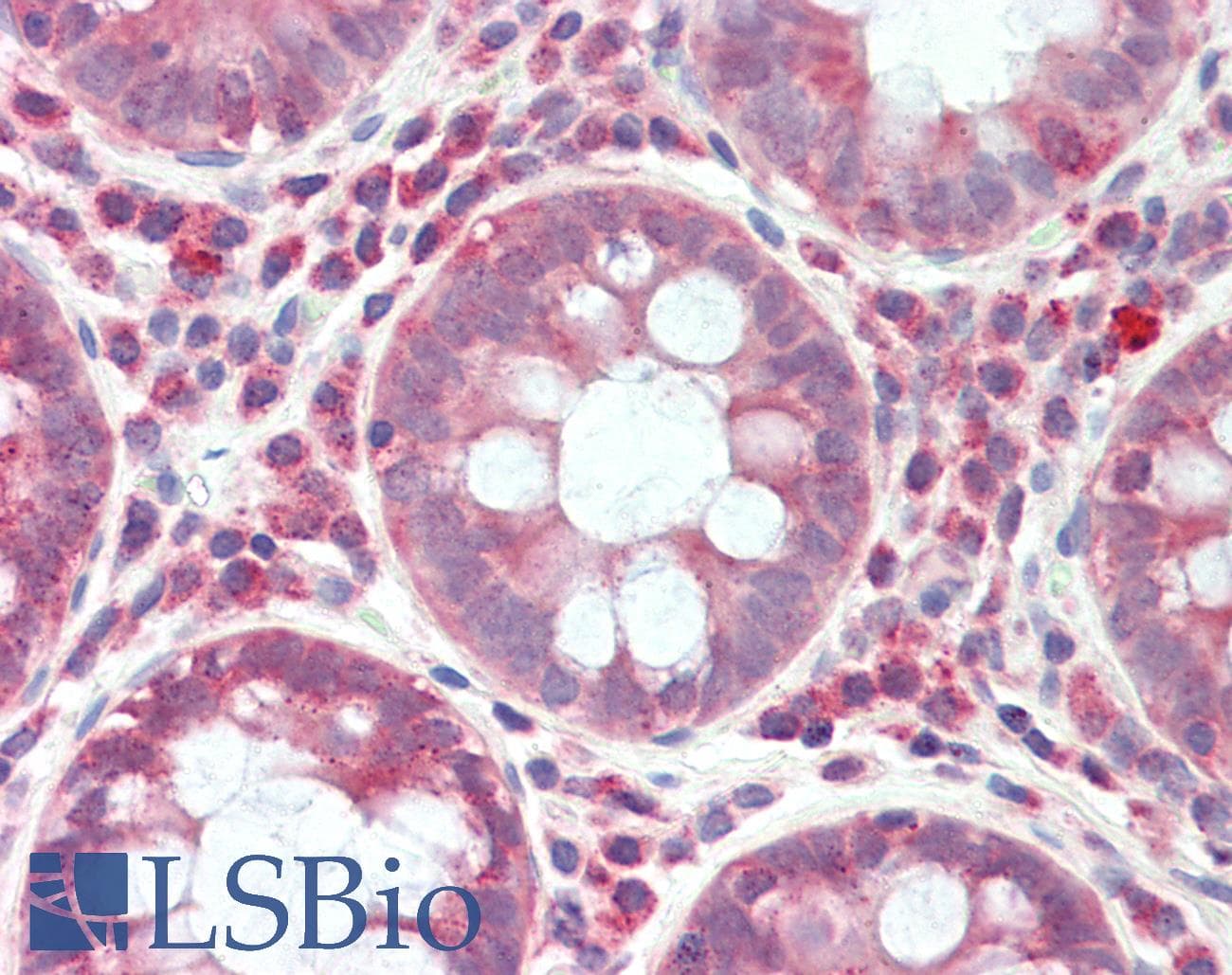 IHC-plus™ Polyclonal Rabbit anti-Human RPS6KC1 Antibody (aa231-280, IHC, IF, WB)