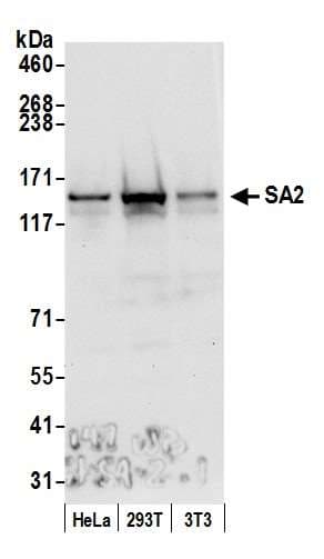 IHC-plus™ STAG2 Antibody (aa1125-1175)