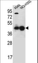 Polyclonal Rabbit anti-Human PURA / Pur-Alpha Antibody (aa259-287, IHC, WB)