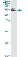 IMPDH2 Antibody (clone 1E12-B6)