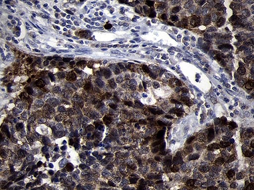 Monoclonal Mouse anti-Human RRM2 Antibody (clone OTI1F2, Carrier-free, IHC, WB)