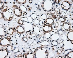 CD36 Antibody (clone OTI3F4)