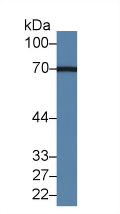 AOAH / Acyloxyacyl Hydrolase Antibody (aa24-300)