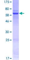 Human WNT3 Protein (Recombinant GST)