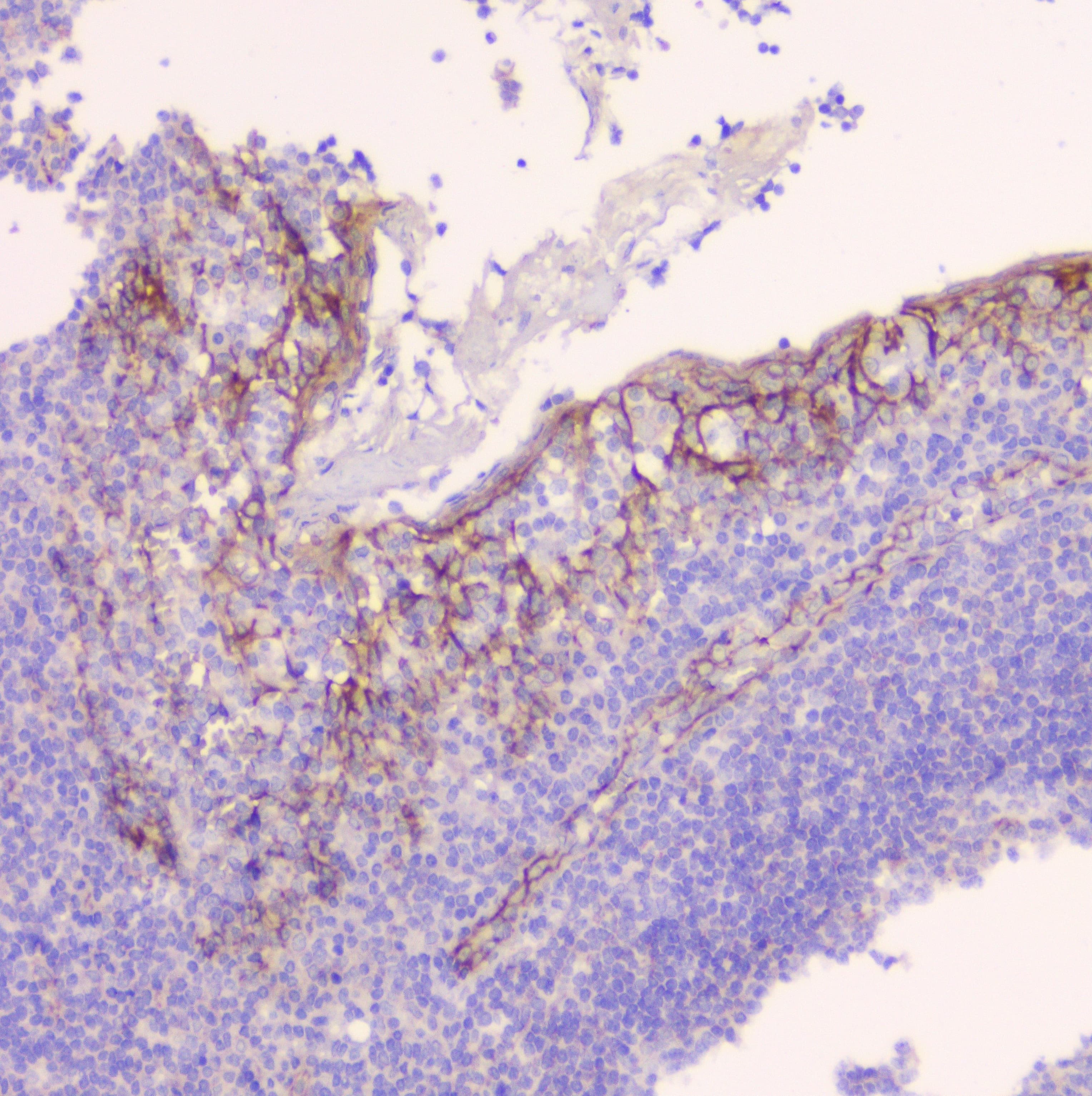 CTNNB1 / Beta Catenin Antibody