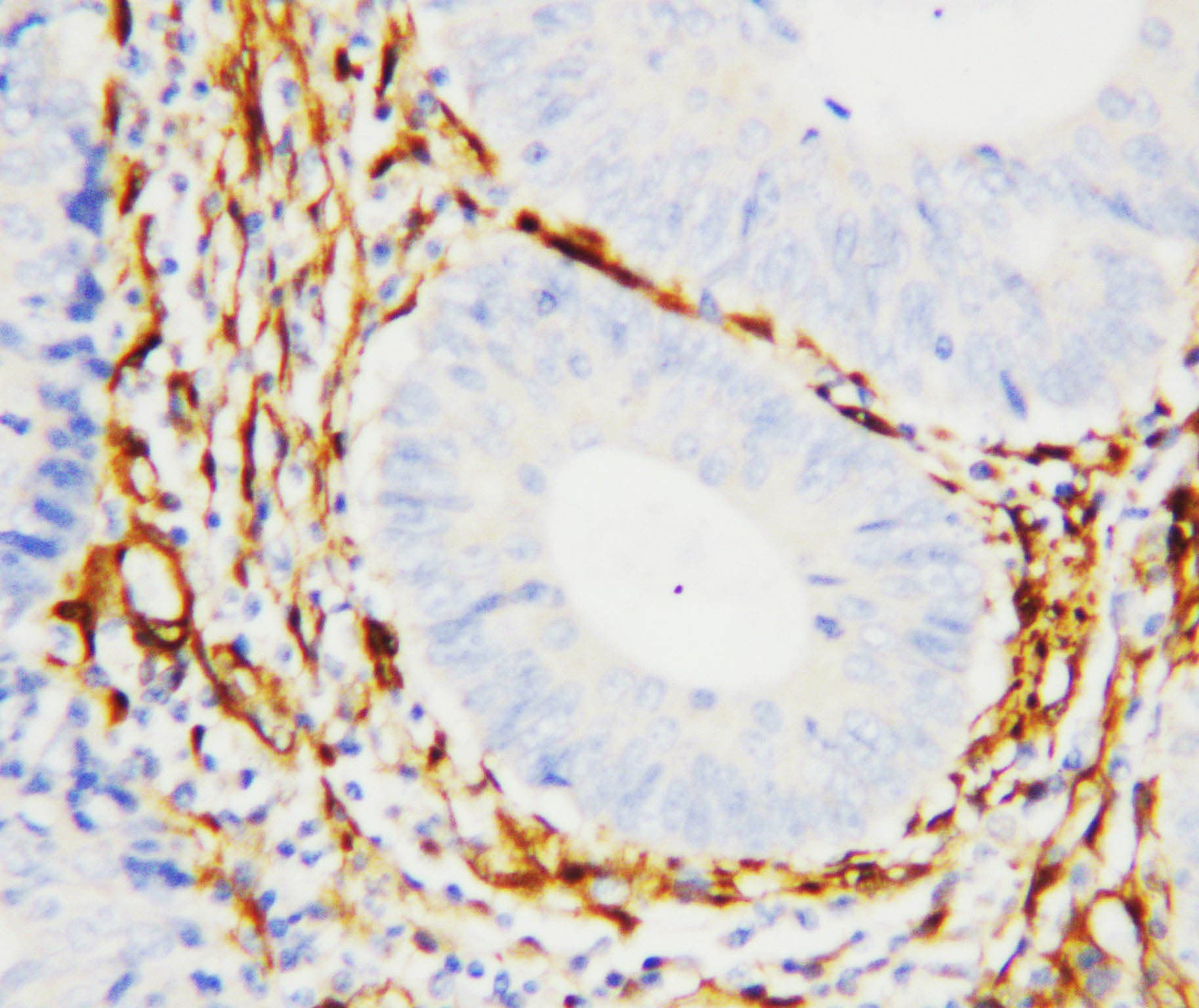 Polyclonal Rabbit anti-Human LGALS1 / Galectin 1 Antibody (aa119-135, IHC, WB)