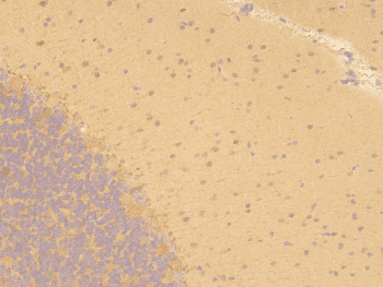 Polyclonal Rabbit anti-Human PPA1 Antibody (IHC, WB)
